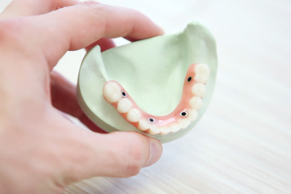 all ceramic crown img