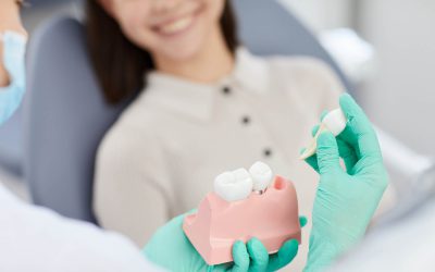 植牙推薦優點多，了解哪種植牙療程適合你