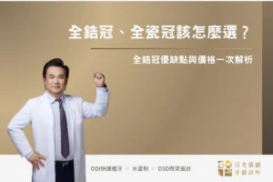 牙齒美白 5 全鋯冠、全瓷冠該怎麼選?全鋯冠優缺點與價格一次解析