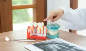 牙齒美白 10 dentist with dental implant model DHMCP67