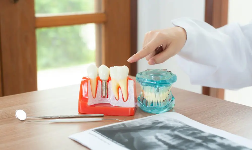 最新消息 2 dentist with dental implant model DHMCP67 scaled e1626776827592