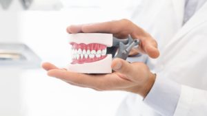hands of dentist holding plastic jaw model ABGMSFV 1