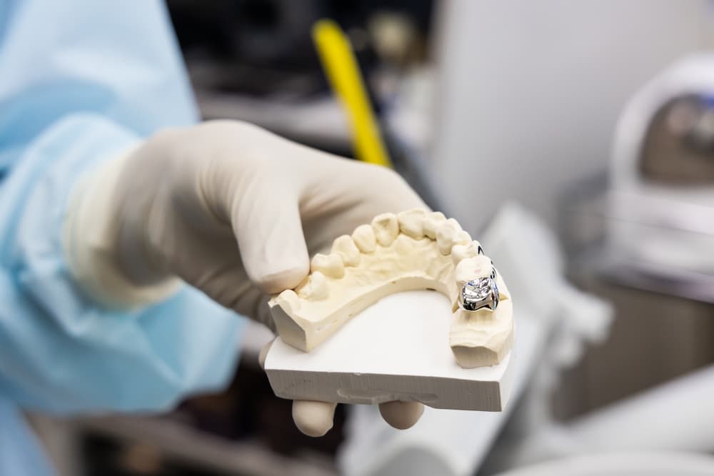 dentist holding dental prosthesis imprint with met 2022 02 05 07 41 10 utc 1