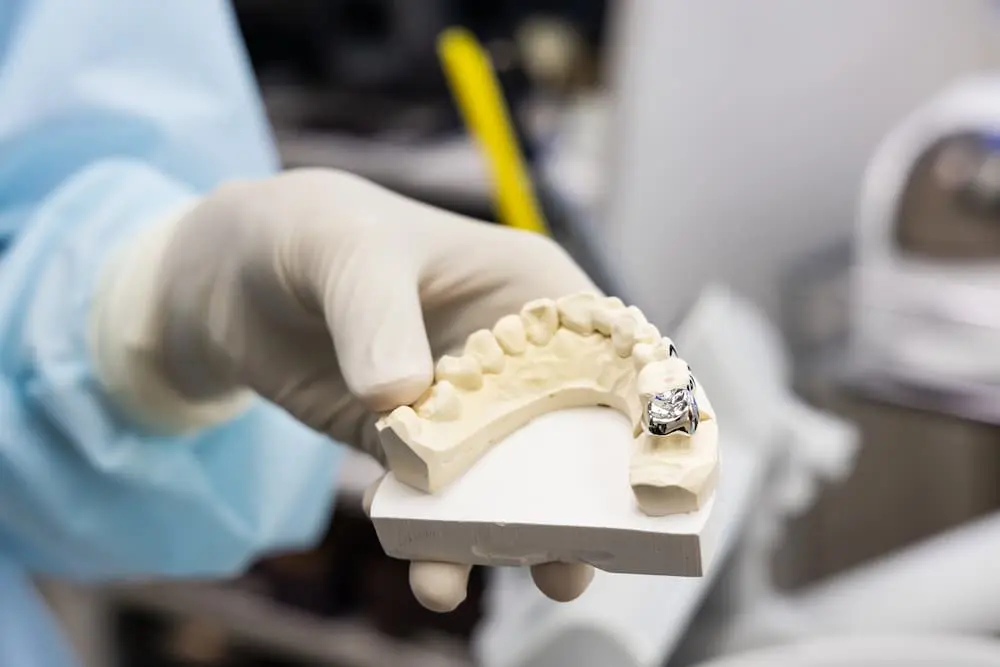 最新消息 8 dentist holding dental prosthesis imprint with met 2022 02 05 07 41 10 utc 1