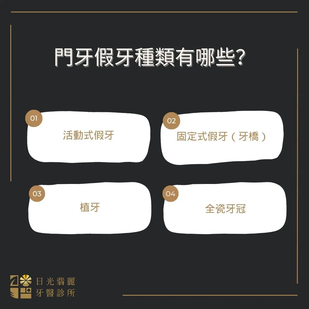 說明門牙假牙種類有哪些